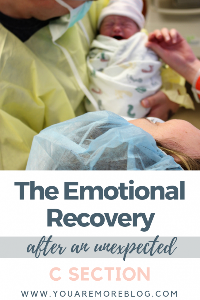 Having an unexpected C-Section can come with a lot of emotions. The emotional recovery after an unexpected c-section.