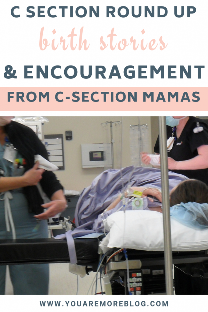 C-Section round up with birth stories and encouragement from other c-section moms.